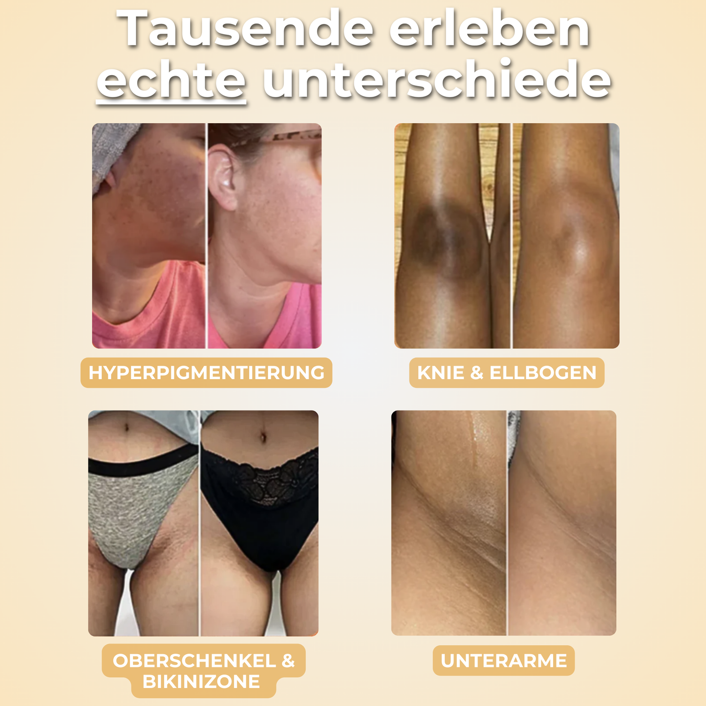 Kurkana® Aufhellende Kurkuma & Koji Seife (2er Pack)