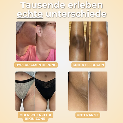 Kurkana® Aufhellende Kurkuma & Koji Seife (2er Pack)